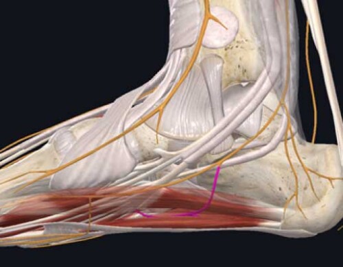 Dolor de talón: neuropatía de Baxter, síntomas y tratamiento