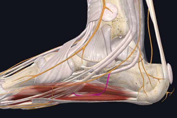 Dolor de talón: neuropatía de Baxter, síntomas y tratamiento